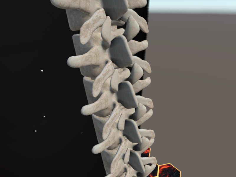 BoneZone