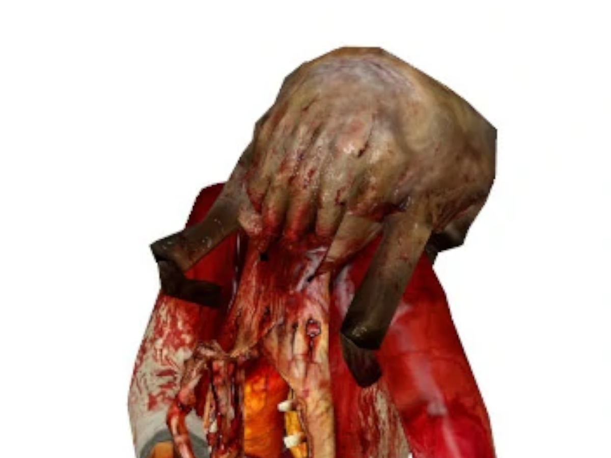 headcrab zombie